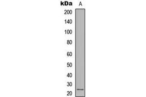 Western blot analysis of IL-12A expression in MDA-MB231 (A) whole cell lysates. (IL12A antibody  (Center))