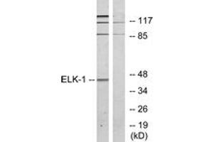 Western blot analysis of extracts from HeLa cells, treated with heat shock, using Elk1 (Ab-389) Antibody. (ELK1 antibody  (AA 356-405))