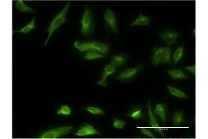 Immunofluorescence of monoclonal antibody to ETNK1 on HeLa cell. (Ethanolamine Kinase 1 antibody  (AA 133-228))