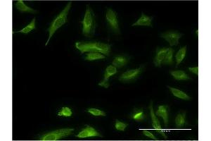 Immunofluorescence of monoclonal antibody to ETNK1 on HeLa cell.