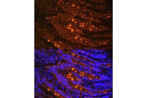 Immunofluorescence (IF) image for anti-Talin 1 (TLN1) (AA 1-220) antibody (ABIN1683044)