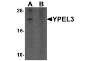 Western blot analysis of YPEL3 in A-20 cell lysate with YPEL3 antibody at 1 ug/mL in (A) the absence and (B) the presence of blocking peptide