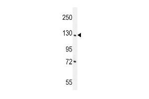 DDX60L Antibody (C-term) (ABIN655540 and ABIN2845051) western blot analysis in NCI- cell line lysates (35 μg/lane). (DDX60L antibody  (C-Term))