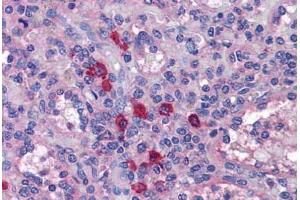Human Spleen: Formalin-Fixed, Paraffin-Embedded (FFPE) (TLR7 antibody  (AA 465-483))