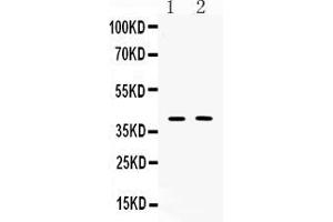 Western blot analysis of Islet 1 expression in PC12 whole cell lysates ( Lane 1) and MCF-7 whole cell lysates ( Lane 2).