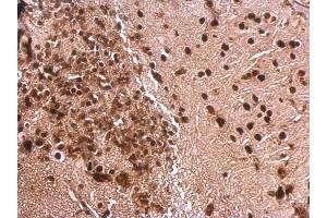 IHC-P Image MEF2A antibody [C2C3], C-term detects MEF2A protein at nucleus on mouse fore brain by immunohistochemical analysis. (MEF2A antibody  (C-Term))
