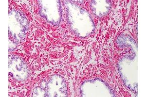 Human Prostate: Formalin-Fixed, Paraffin-Embedded (FFPE) (SLC5A3 antibody)