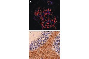 Immunostaining of a glomerolus in in a mouse kidney section (dilution 1 : 200). (SYNPO antibody  (Isoform 2))