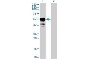 Western Blot analysis of STAM expression in transfected 293T cell line by STAM monoclonal antibody (M01), clone 2B11-1G1.