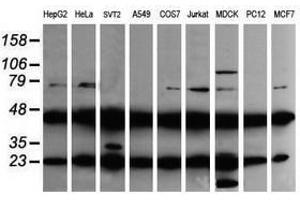 Image no. 2 for anti-Mitogen-Activated Protein Kinase Kinase 1 (MAP2K1) antibody (ABIN1499377) (MEK1 antibody)