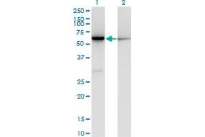 Western Blot analysis of CBS expression in transfected 293T cell line by CBS monoclonal antibody (M02), clone 3D10. (CBS antibody  (AA 1-100))