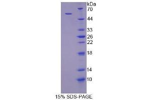 SDS-PAGE analysis of Human TGOLN2 Protein. (TGOLN2 Protein)
