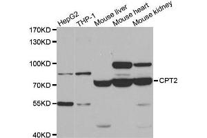 Western blot analysis of extracts of various cell lines, using CPT2 antibody. (CPT2 antibody)