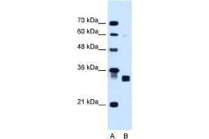WB Suggested Anti-CBR1 Antibody Titration:  1.