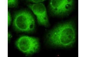 Immunocytochemistry of HeLa cells using anti-CDK5(N-terminus) mouse mAb diluted 1:150 (CDK5 antibody  (N-Term))