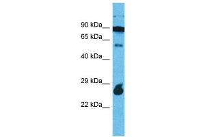 Western Blotting (WB) image for anti-Rap Guanine Nucleotide Exchange Factor (GEF)-Like 1 (RAPGEFL1) (C-Term) antibody (ABIN2791893) (RAPGEFL1 antibody  (C-Term))
