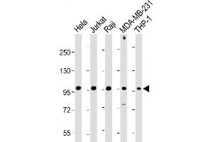 All lanes : Anti-NLRP3 Antibody (N-term) at 1:1000-1:2000 dilution Lane 1: Hela whole cell lysate Lane 2: Jurkat whole cell lysate Lane 3: Raji whole cell lysate Lane 4: MDA-MB-231 whole cell lysate Lane 5: THP-1 whole cell lysate Lysates/proteins at 20 μg per lane. (NLRP3 antibody  (N-Term))