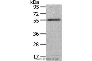 Western blot analysis of 293T cell, using ENPP7 Polyclonal Antibody at dilution of 1:700 (ENPP7 antibody)
