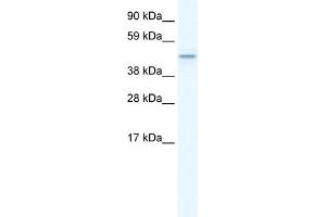 WB Suggested Anti-TMEM108 Antibody Titration:  1. (TMEM108 antibody  (Middle Region))