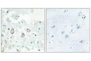 Immunohistochemistry analysis of paraffin-embedded human brain tissue using DOK7 antibody. (DOK7 antibody  (N-Term))