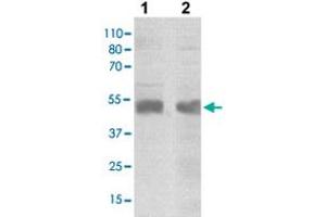 The tissue/cell lysates derived from mouse brain (lane 1), HeLa (lane 2) were immuno-probed by SOCS4 polyclonal antibody  at 1 : 500.