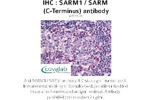 Image no. 1 for anti-Sterile alpha and TIR Motif Containing 1 (SARM1) antibody (ABIN1739028) (SARM1 antibody)