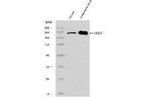 Western blot analysis of heavy chain Myosin/MYH3 using anti-heavy chain Myosin/MYH3 antibody (ABIN7601736).