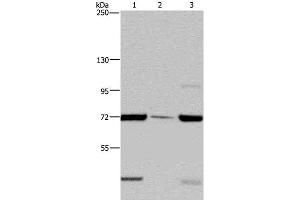 Western Blot analysis of LoVo cell, Human testis tissue and A549 cell using FAAH Polyclonal Antibody at dilution of 1:400 (FAAH antibody)
