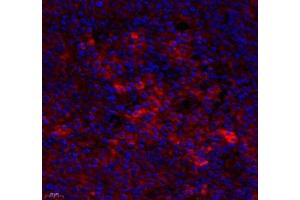 Immunofluorescence of paraffin embedded human tonsil using MS4A2 (ABIN7074594) at dilution of 1: 400 (400x lens) (MS4A2 antibody)