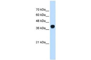 SQLE antibody used at 0. (SQLE antibody  (C-Term))