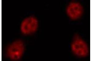 Immunofluorescence (fixed cells) (IF/ICC) image for anti-Ataxin 1 (ATXN1) (C-Term) antibody (ABIN6260085)