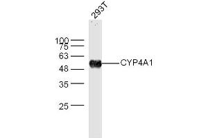 293T lysates probed with CYP4A1 Polyclonal Antibody, Unconjugated  at 1:300 dilution and 4˚C overnight incubation. (CYP4A11 antibody  (AA 351-450))
