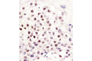 Antibody staining LIN28B in human testis tissue sections by Immunohistochemistry (IHC-P - paraformaldehyde-fixed, paraffin-embedded sections). (LIN28B antibody  (AA 95-128))