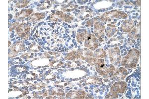 Immunohistochemistry (IHC) image for anti-Interferon-Induced Protein 44-Like (IFI44L) (N-Term) antibody (ABIN2782525) (IFI44L antibody  (N-Term))