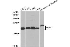 Western blot analysis of extracts of various cell lines, using APRT antibody.