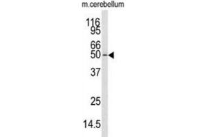 Western Blotting (WB) image for anti-Calcium/calmodulin-Dependent Protein Kinase Kinase 1, alpha (CAMKK1) antibody (ABIN3003479) (CAMKK1 antibody)