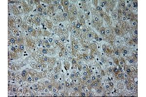 Immunohistochemical staining of paraffin-embedded liver tissue using anti-NEUROG1mouse monoclonal antibody. (Neurogenin 1 antibody)