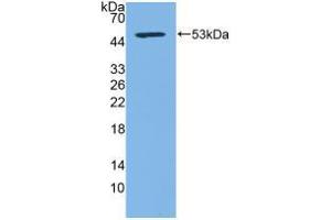 Western blot analysis of recombinant Human CD83.