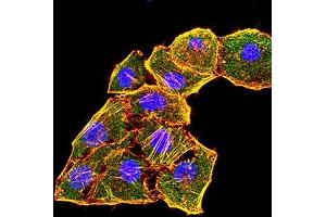 Immunofluorescence analysis of Hela cells using KRT6A mouse mAb (green). (KRT6A antibody  (AA 253-352))