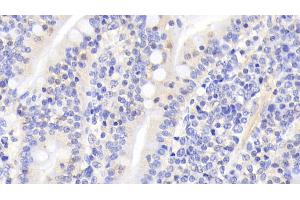 Detection of INHbA in Human Small intestine Tissue using Monoclonal Antibody to Inhibin Beta A (INHbA) (INHBA antibody  (AA 311-426))