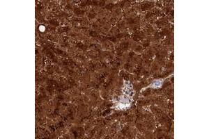 Immunohistochemical staining of human liver with TTC36 polyclonal antibody  shows strong cytoplasmic and nuclear positivity in hepatocytes. (TTC36 antibody)