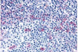 Anti-CCR7 antibody  ABIN1048400 IHC staining of human lymph node. (CCR7 antibody  (C-Term))