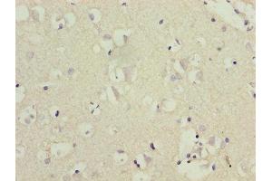 Immunohistochemistry of paraffin-embedded human brain tissue using ABIN7148625 at dilution of 1:100