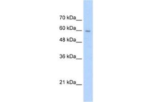 Western Blotting (WB) image for anti-Solute Carrier Family 22 (Organic Cation Transporter), Member 1 (SLC22A1) antibody (ABIN2462426)