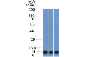 Western Blot of HeLa, A549 and A375 cell lysates using S100A4 Mouse Monoclonal Antibody (S100A4/1481). (s100a4 antibody  (AA 1-200))