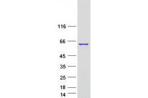 Validation with Western Blot (NONO Protein (Transcript Variant 3) (Myc-DYKDDDDK Tag))