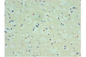 Immunohistochemistry of paraffin-embedded human brain tissue using ABIN7170477 at dilution of 1:100 (SPAG16 antibody  (AA 1-183))