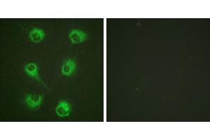 Peptide - +Immunofluorescence analysis of HuvEc cells, using CrkL (Ab-207) antibody (#B0067). (CrkL antibody  (Tyr207))