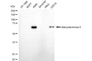 anti-Adenylate Kinase 5 (AK5) antibody