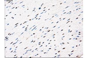 Immunohistochemical staining of paraffin-embedded Ovary tissue using anti-AKR1A1mouse monoclonal antibody. (AKR1A1 antibody)